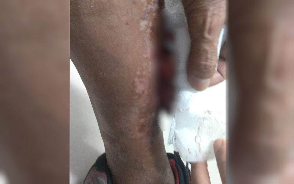 Idoso agredido por neto teve corte de aproximadamente 8 centímetros na perna  — Foto: Divulgação/Polícia Civil
