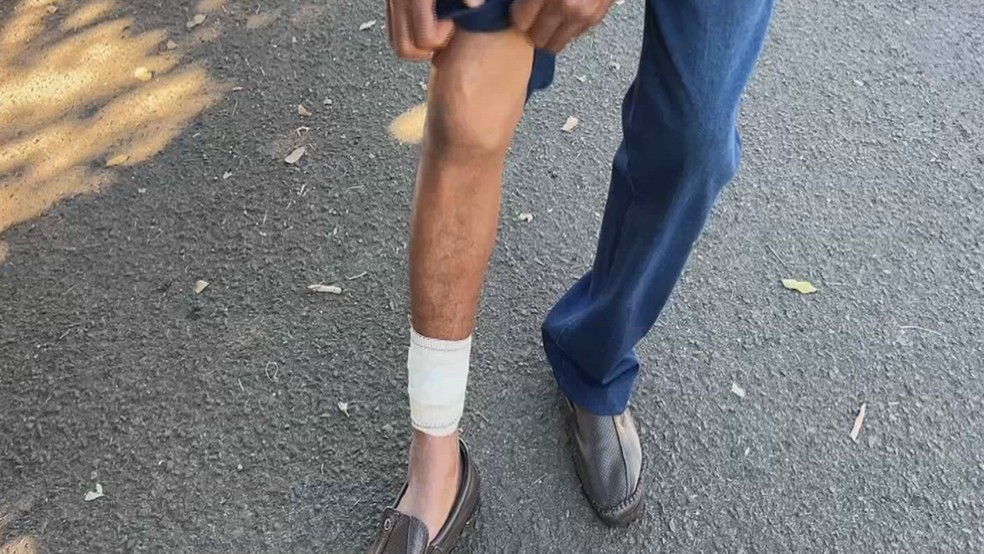 Homem atacado por pitbull em Santa Fé do Sul (SP), nesta terça (12), mostra curativo na perna, onde sofreu ferimentos; um idoso de 80 anos teve o braço amputado por causa do ataque — Foto: TV TEM/Reprodução