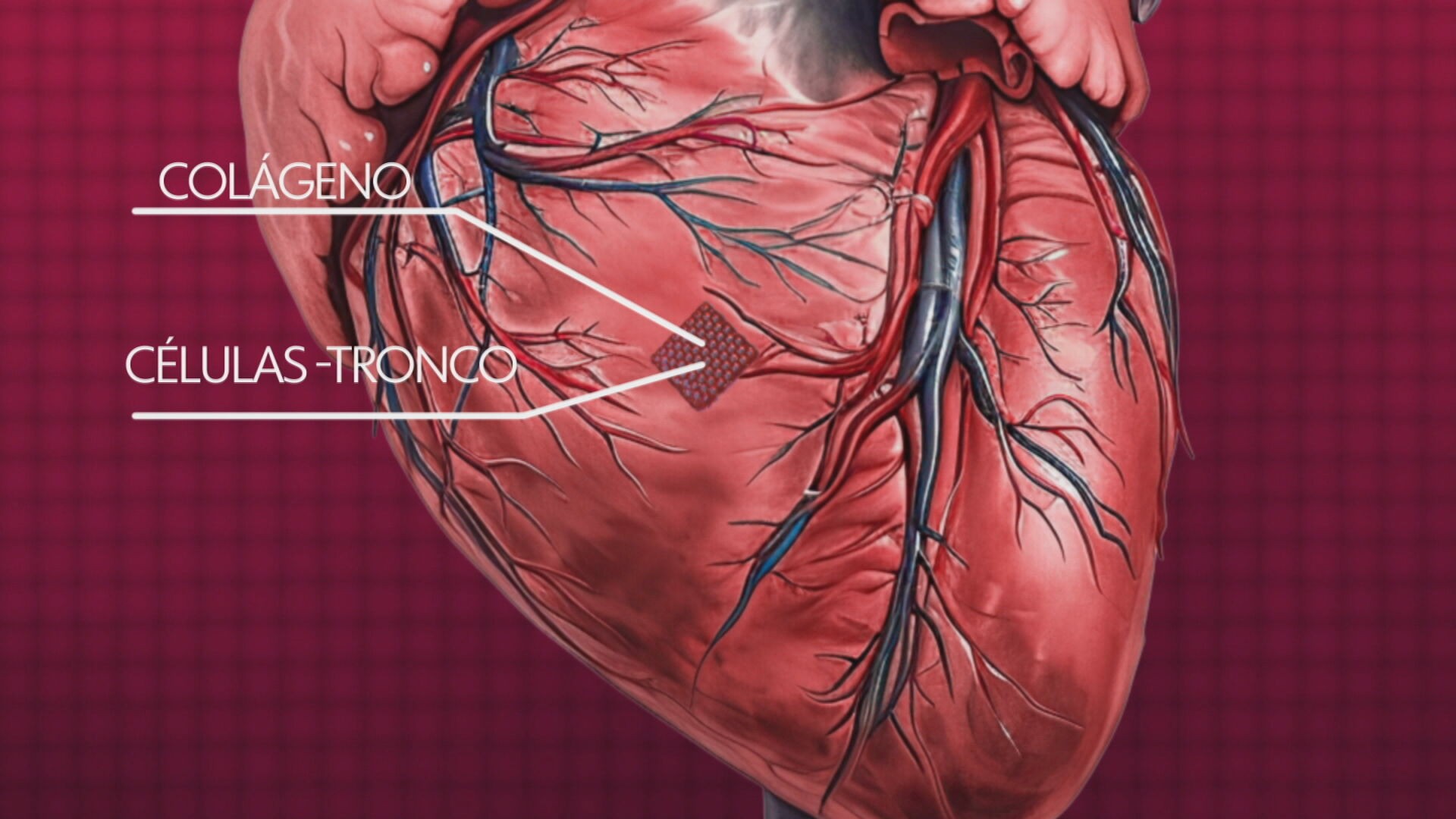 Relógio que previne doenças e curativo para corações infartados: as tecnologias que prometem revolucionar a medicina   