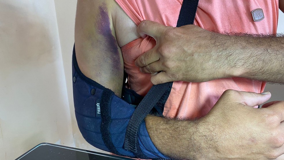 Com bra&ccedil;o quebrado, paciente descobre no hospital que atendimento foi remarcado em hospital de Natal &mdash; Foto: Francielly Medeiros / Inter TV Cabugi