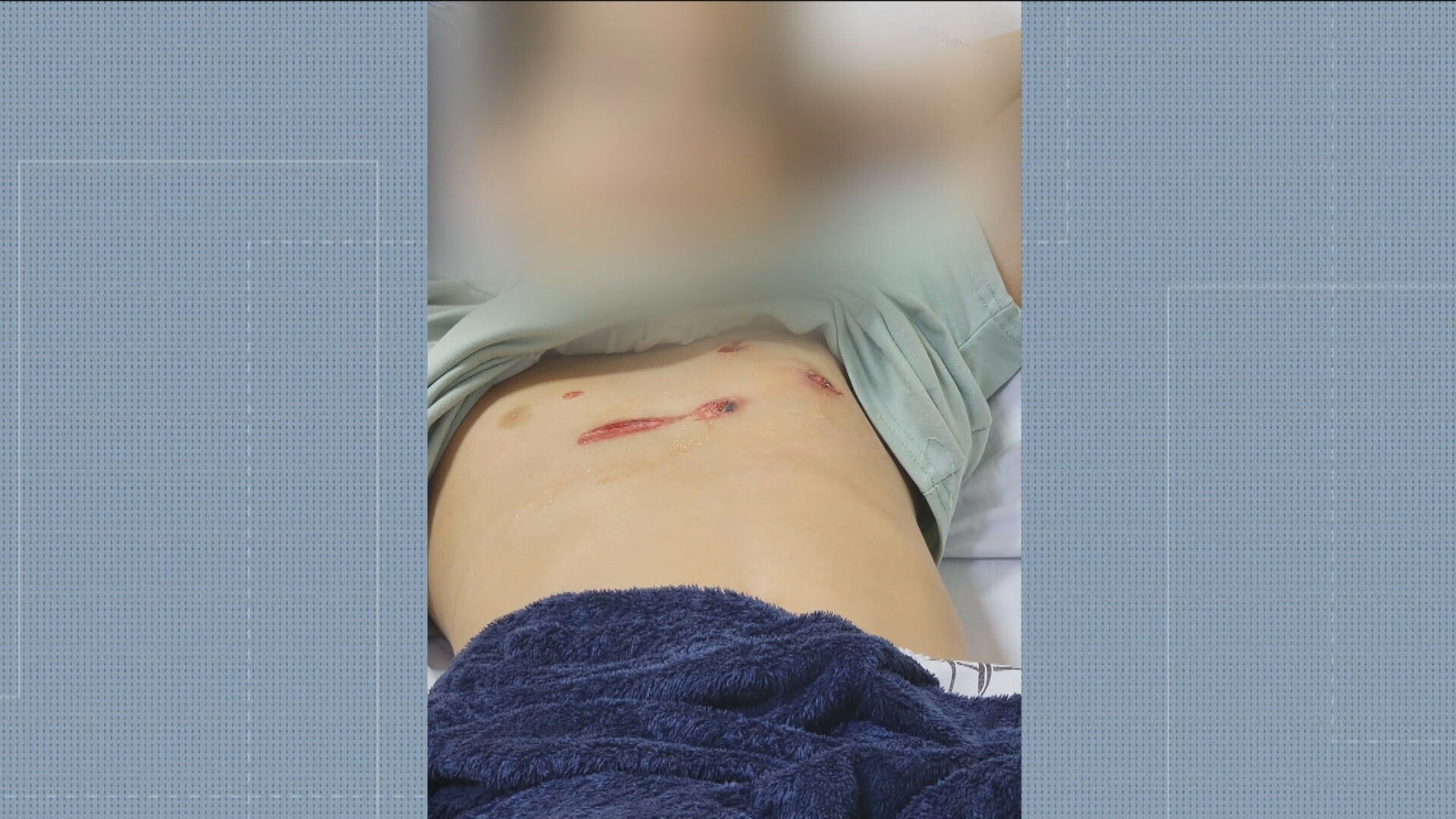 Duas crianças ficam feridas durante tentativa de assalto na Pavuna