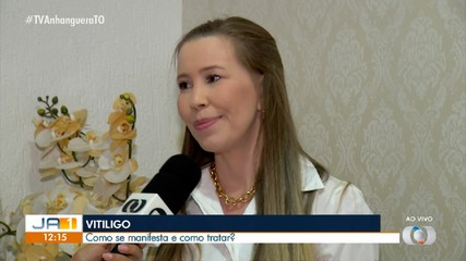 Especialista explica como o vitiligo se manifesta e como tratar