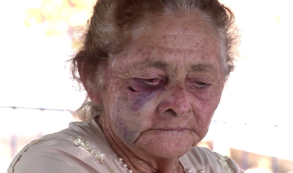 Maria Auxiliadora, 71 anos, sobrevivente do acidente que matou sete familiares em Ouricuri — Foto: Reprodução /TV Grande Rio