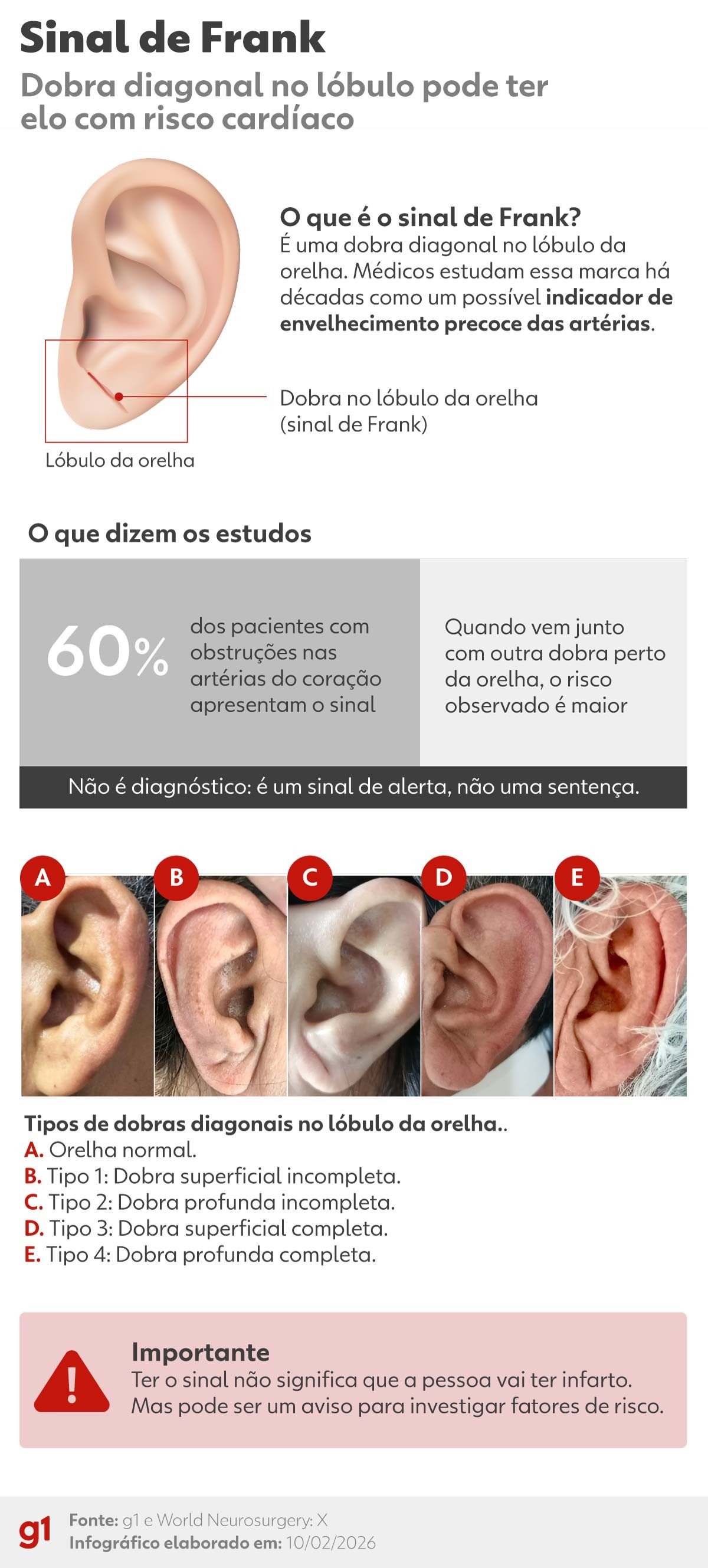 Dobra na orelha: o que fazer se você tem o sinal de Frank e quais os ...