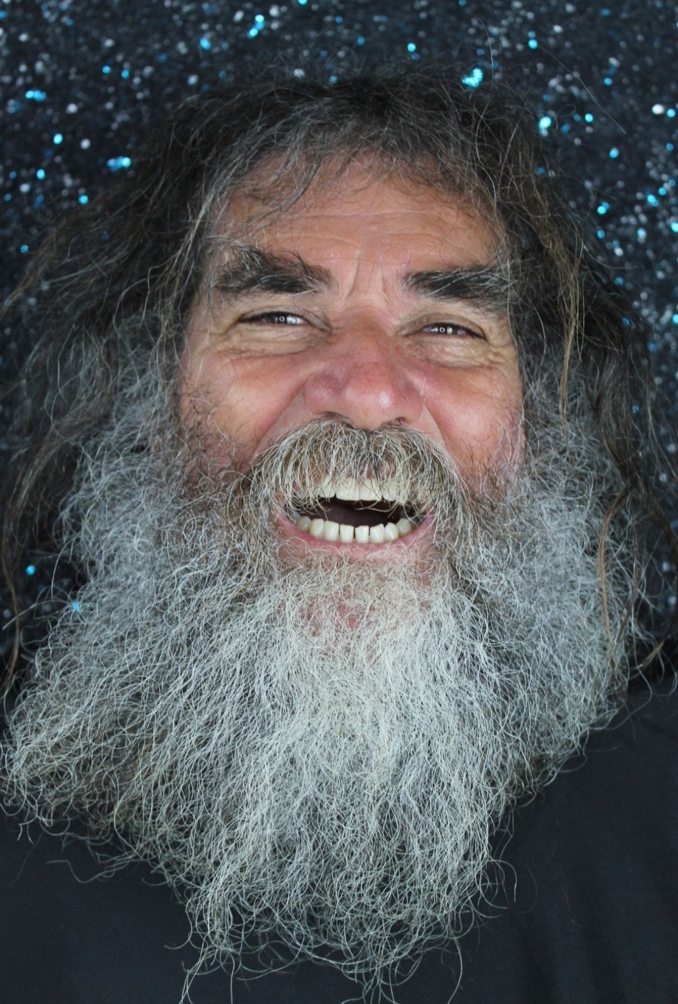 Valdemar antes da transformação, com barba, cabelo comprido e dentes sem tratamento, em Fartura (SP) — Foto: Késia Nochelli/Divulgação
