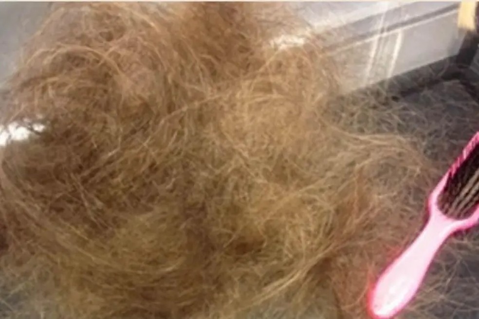 Apesar de usar uma touca térmica durante a quimioterapia, Victoria perdeu entre 50% e 75% do cabelo — Foto: Victoria Derbyshire