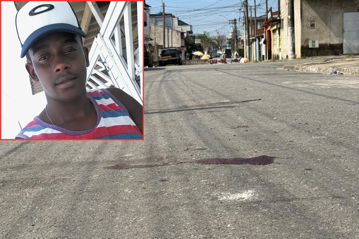 Jovem leva paulada na cabeça em tentativa de feminicídio no litoral de SP; ex-marido é investigado