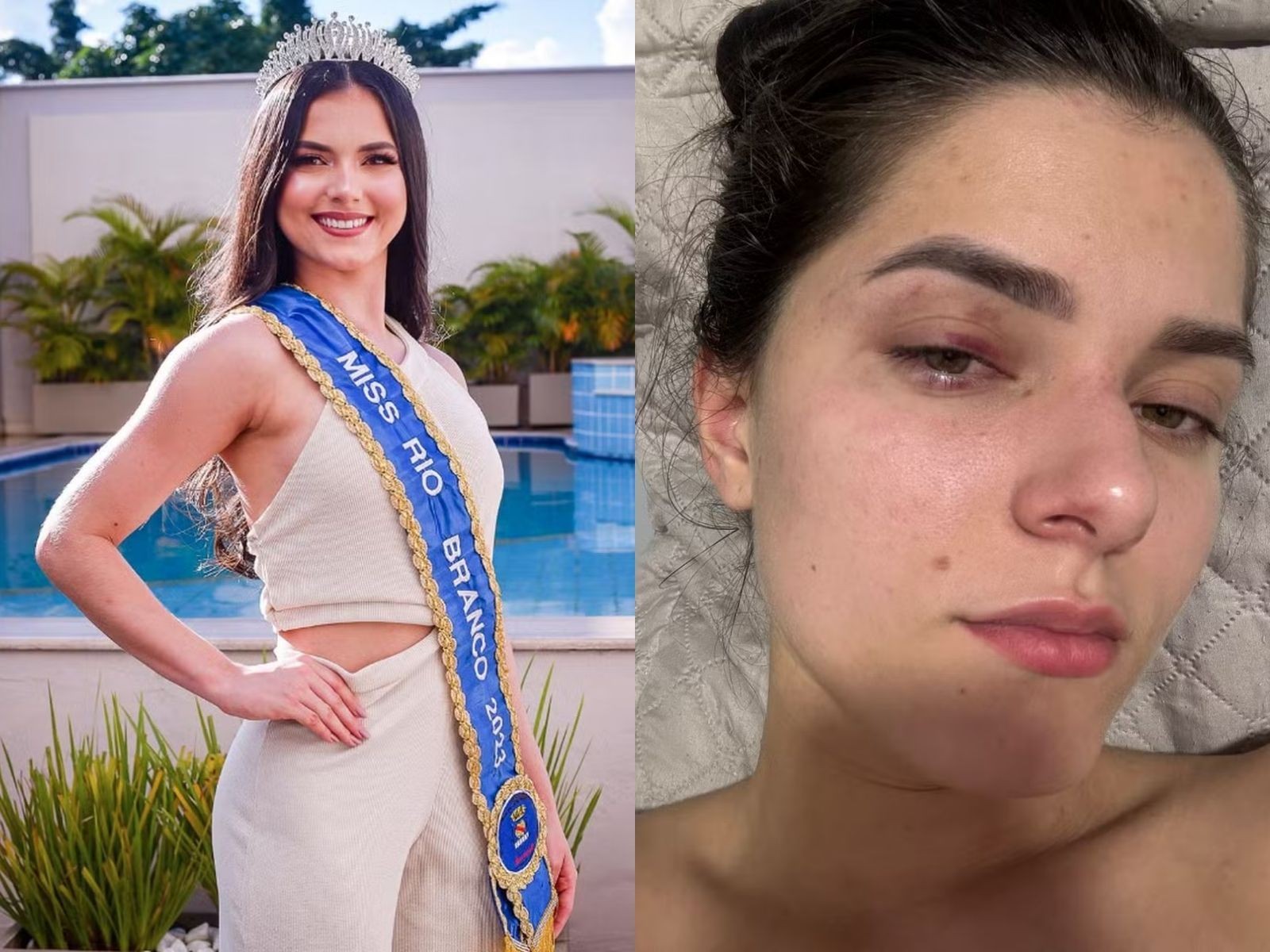 Empresário é condenado por agredir e ameaçar ex-Miss Universo Rio Branco após crise de ciúmes