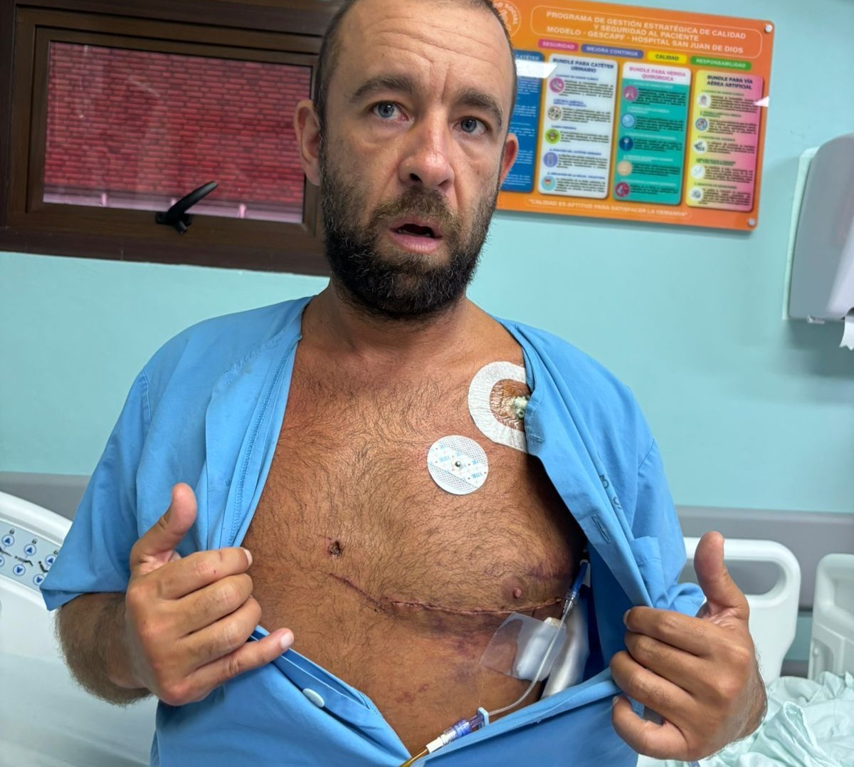 'Sucessão de milagres': quem é o brasileiro atingido no coração por peixe-espada na Costa Rica