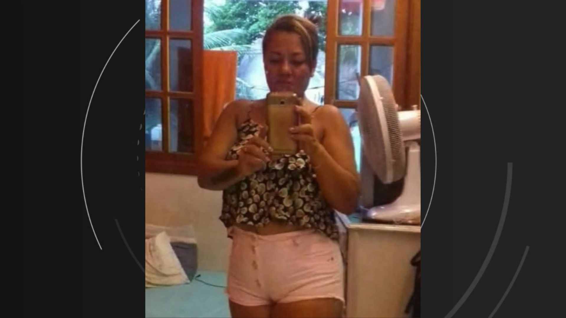 Polícia investiga morte de mulher que morreu queimada após sete dias de internação no ES