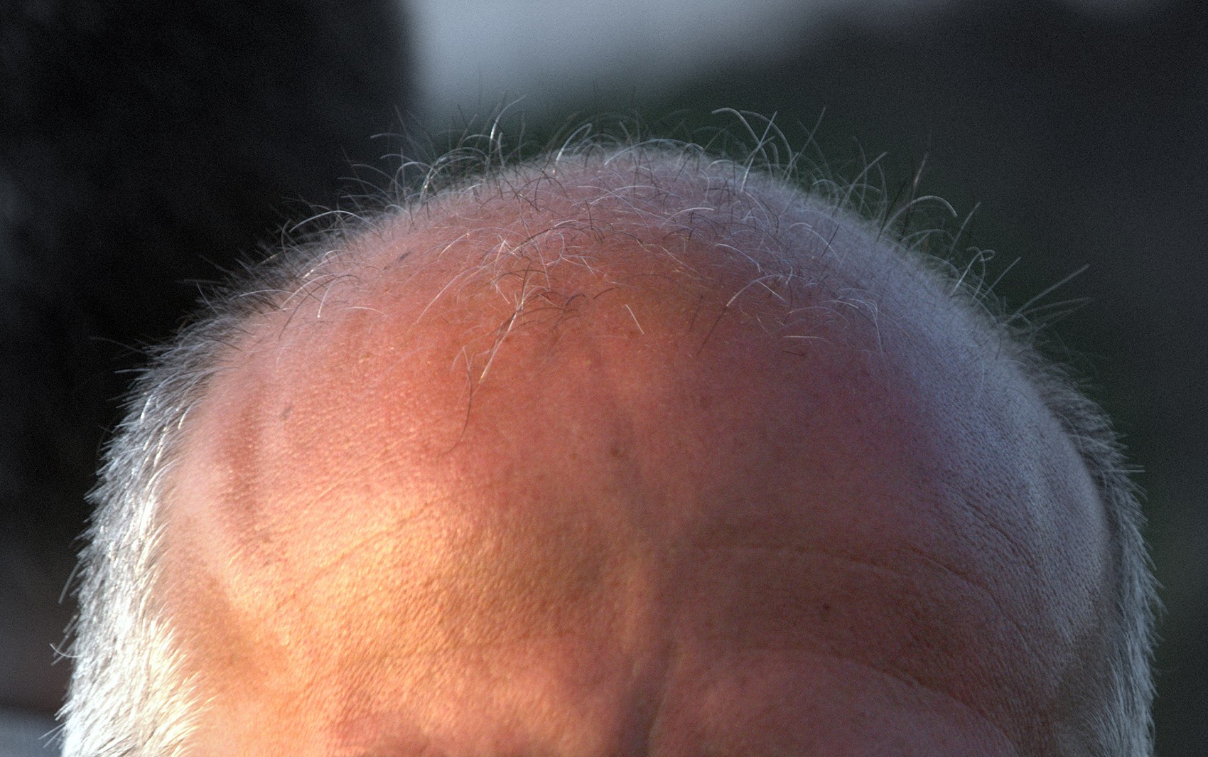 É #FAKE que mistura de alecrim, folhas de goiaba, cravo, canela e óleo de rícino combate calvície e faz cabelo crescer
