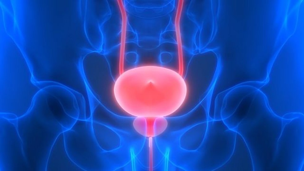 O câncer de próstata é um dos mais comuns entre os homens — Foto: Getty Images