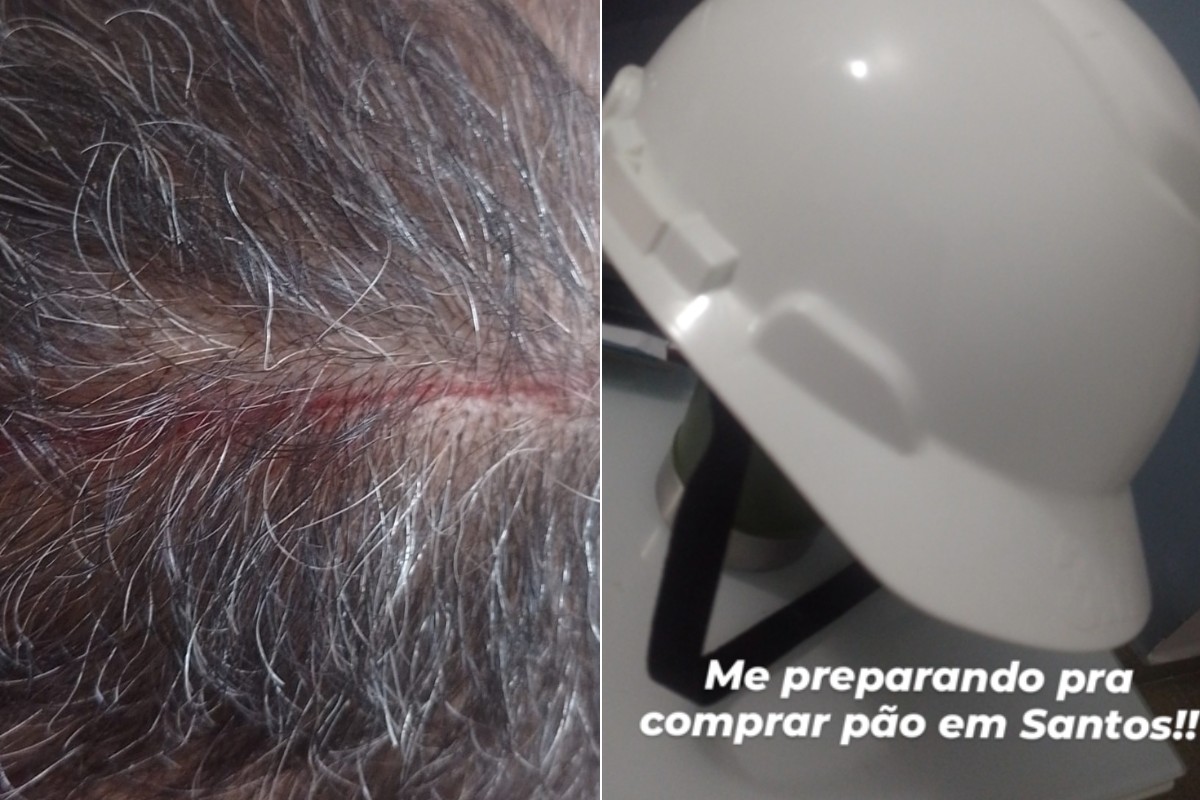 Homem é atacado por gavião e brinca que vai precisar de capacete para andar em Santos