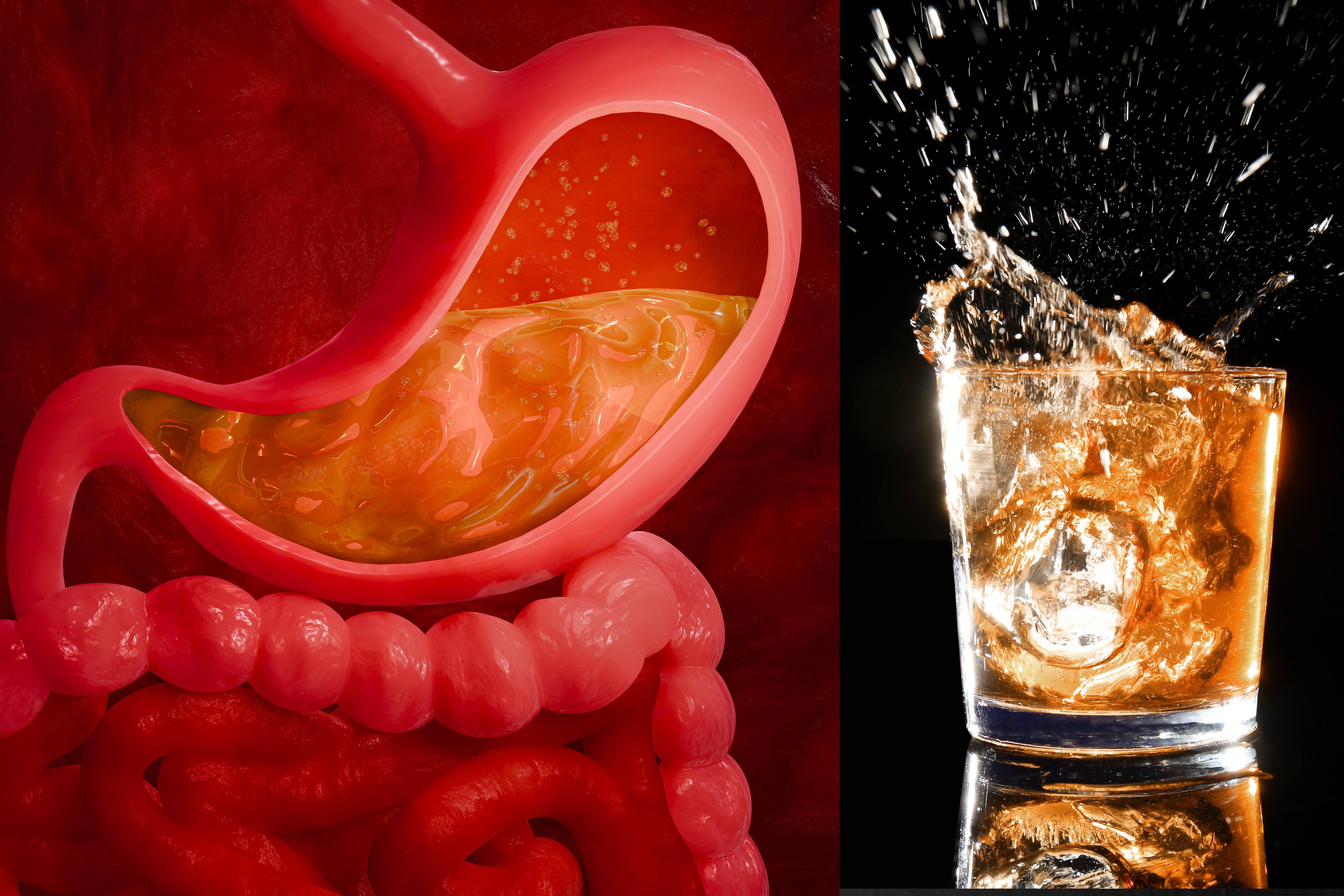 Álcool x cirurgia bariátrica: entenda por que histórico de alcoolismo pode fazer o paciente ser vetado do procedimento