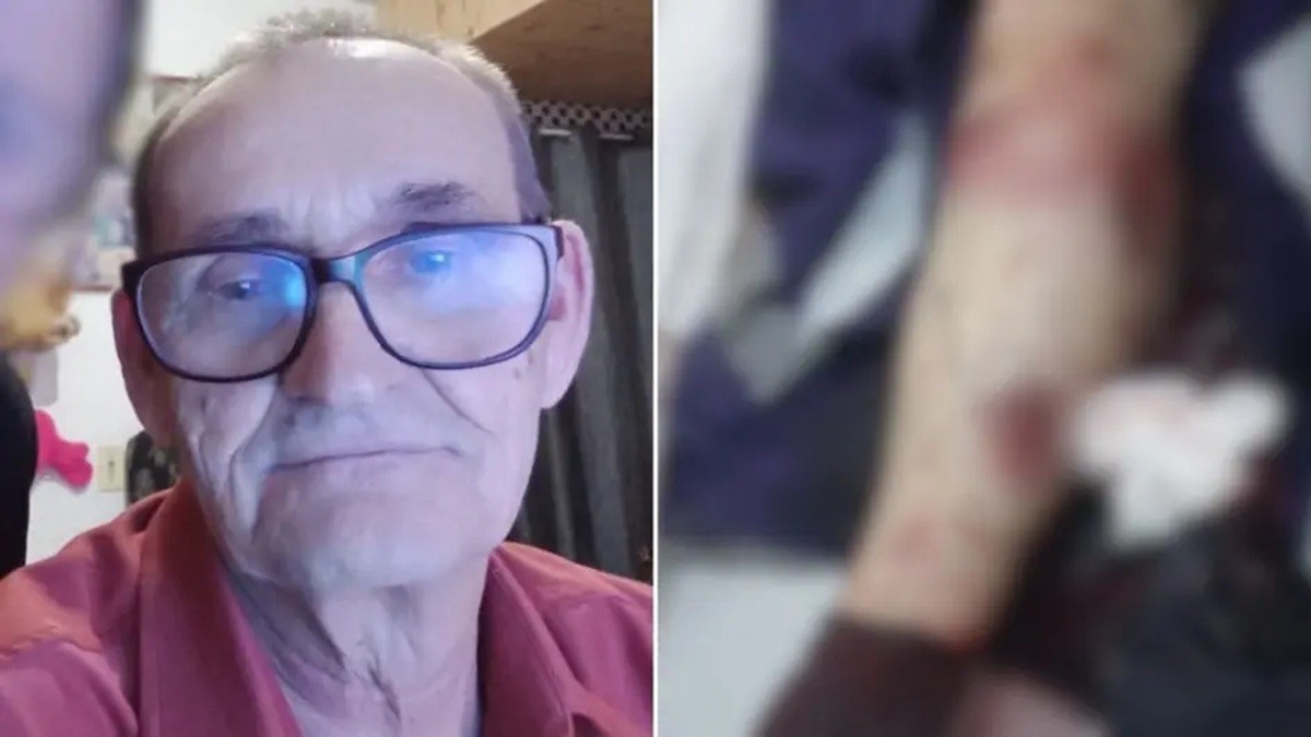 Trabalhador de 70 anos é atacado por pit bull durante leitura de medidor de energia e é internado no hospital em SC