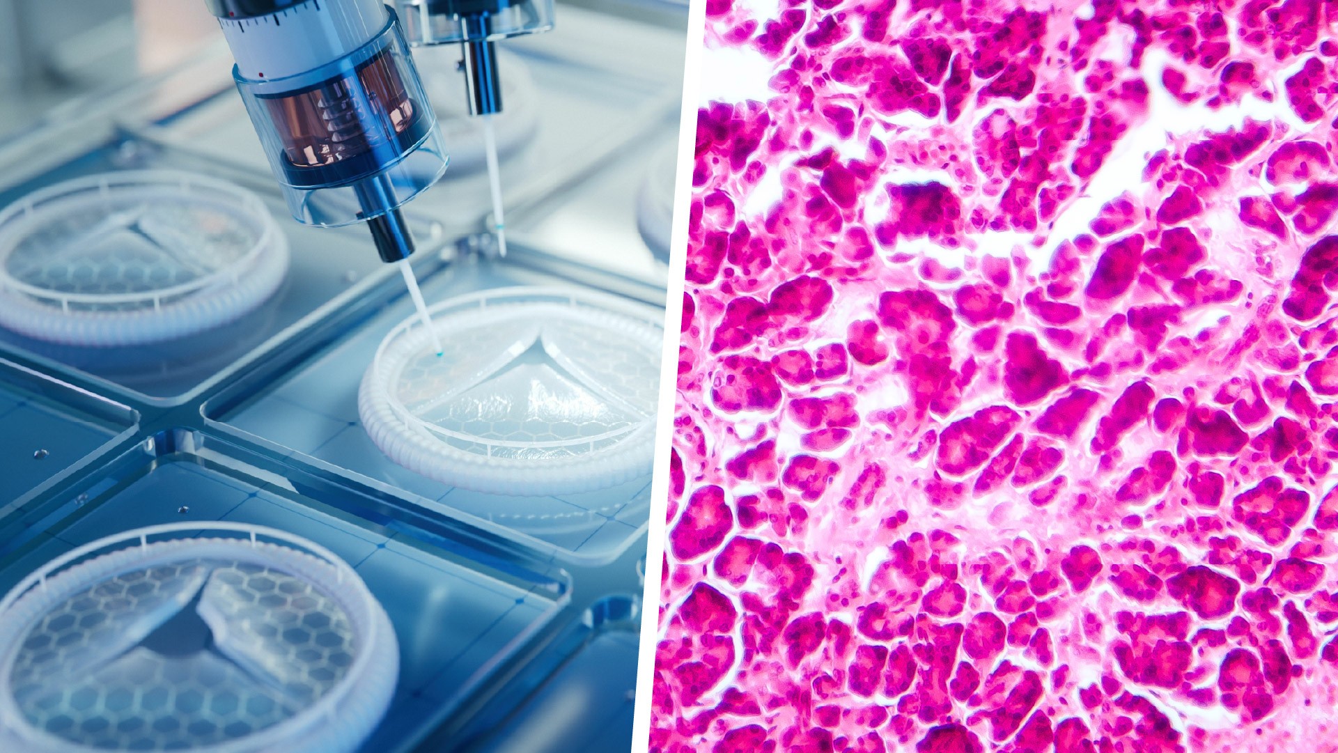 Impressão 3D de células pode eliminar necessidade de insulina para quem tem diabete tipo 1, dizem cientistas