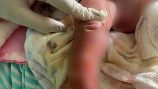 'Estou sem chão', diz pai de recém-nascida internada na UTI após banho em maternidade no Acre