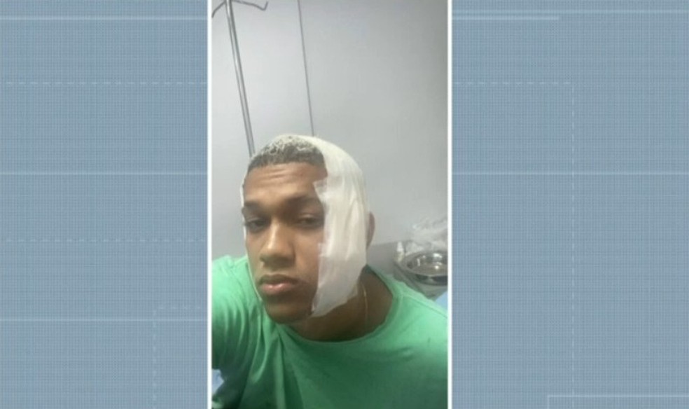 Lucas Silva levou 37 pontos no rosto — Foto: Arquivo pessoal