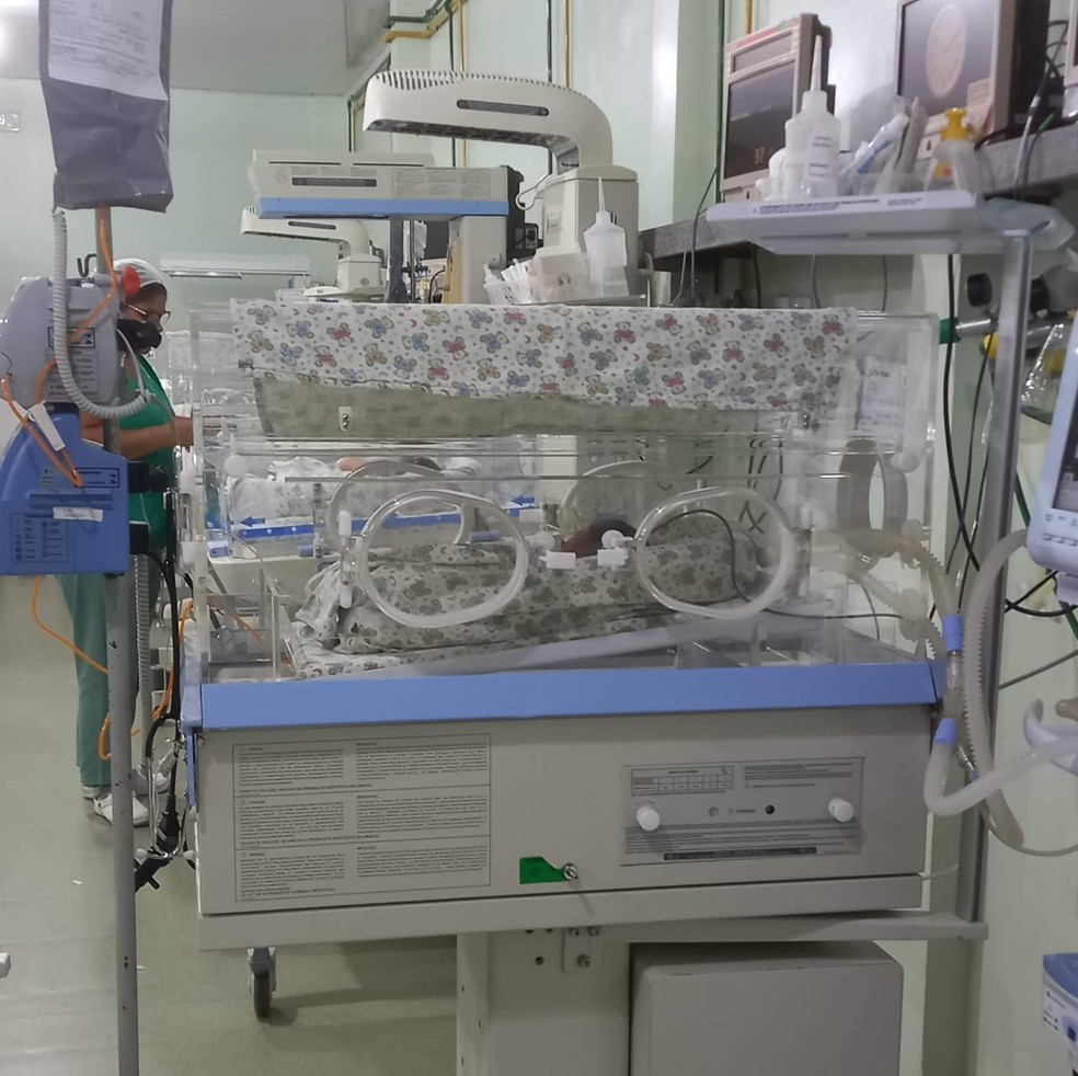 O bebê está sendo monitorado pela equipe médica da Maternidade de Alto Risco de Imperatriz (MARI), a 629 km de São Luís — Foto: Reprodução
