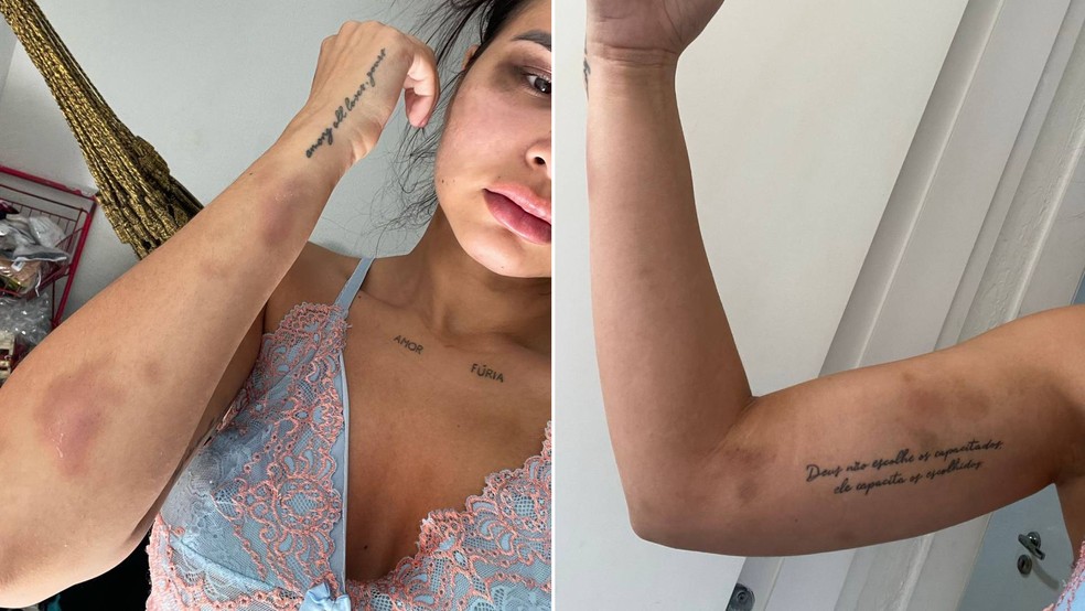 Modelo denuncia ter sido agredido pelo ex-companheiro em Fortaleza — Foto: Reprodução