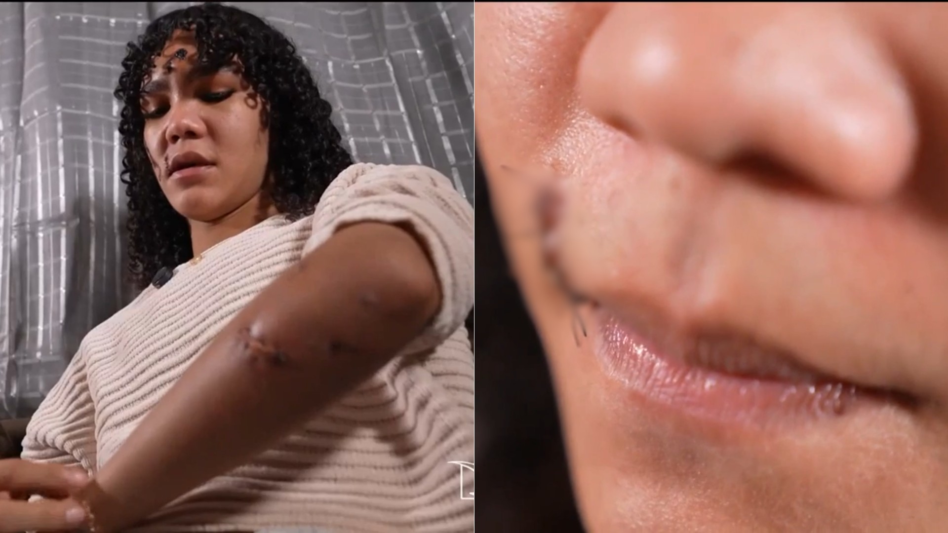 ‘Não conseguia me olhar no espelho’, diz mulher trans atacada com garrafa quebrada em Rosário, no MA