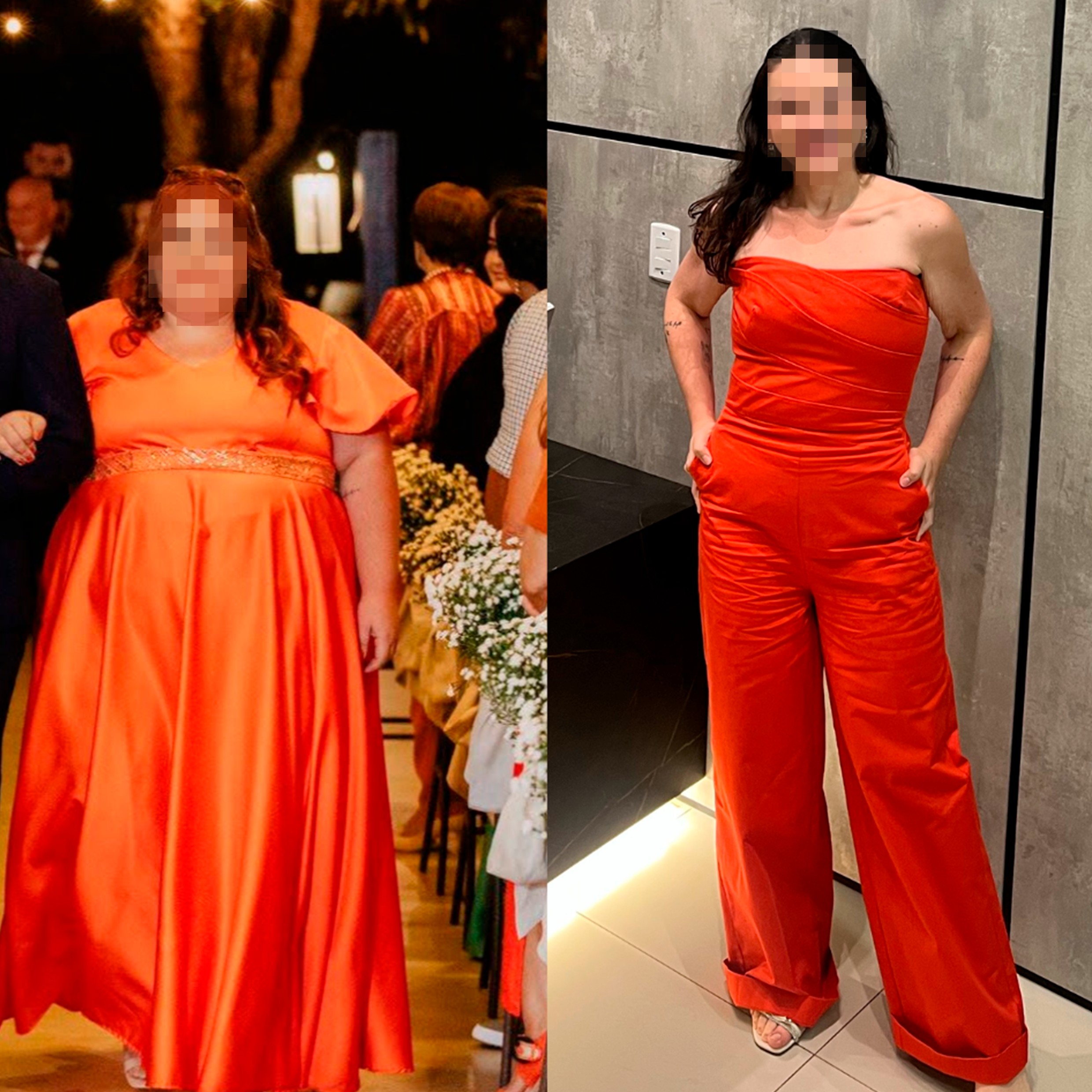 Obesidade é doença crônica e lipedema pode explicar dores e inchaço nas pernas