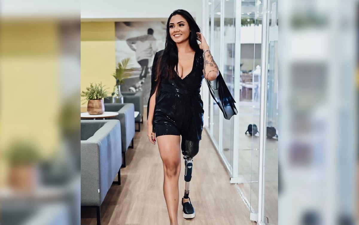 Goiana que teve perna amputada após câncer bomba na web compartilhando rotina: 'Mais que exemplo de superação'