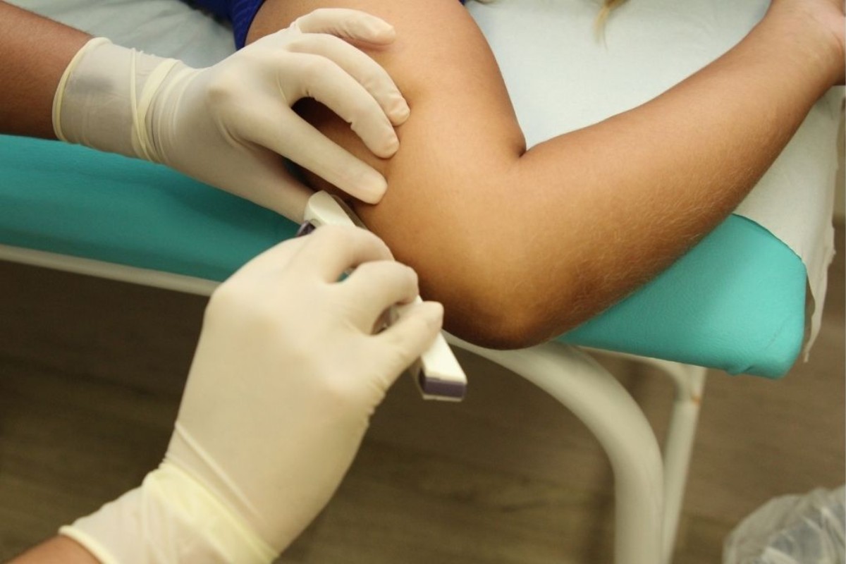 São Vicente abre inscrições para aplicação de 250 contraceptivos em adolescentes