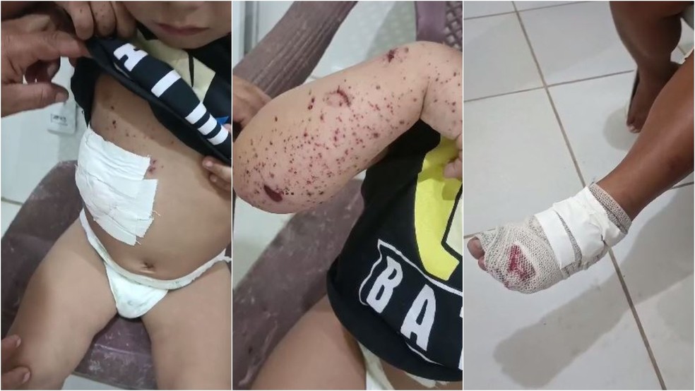 Criança, mãe e avó ficaram feridos após casa ser atingida por raio em Jijoca de Jericoacoara, no litoral do Ceará. — Foto: Idomilson Martins/Reprodução