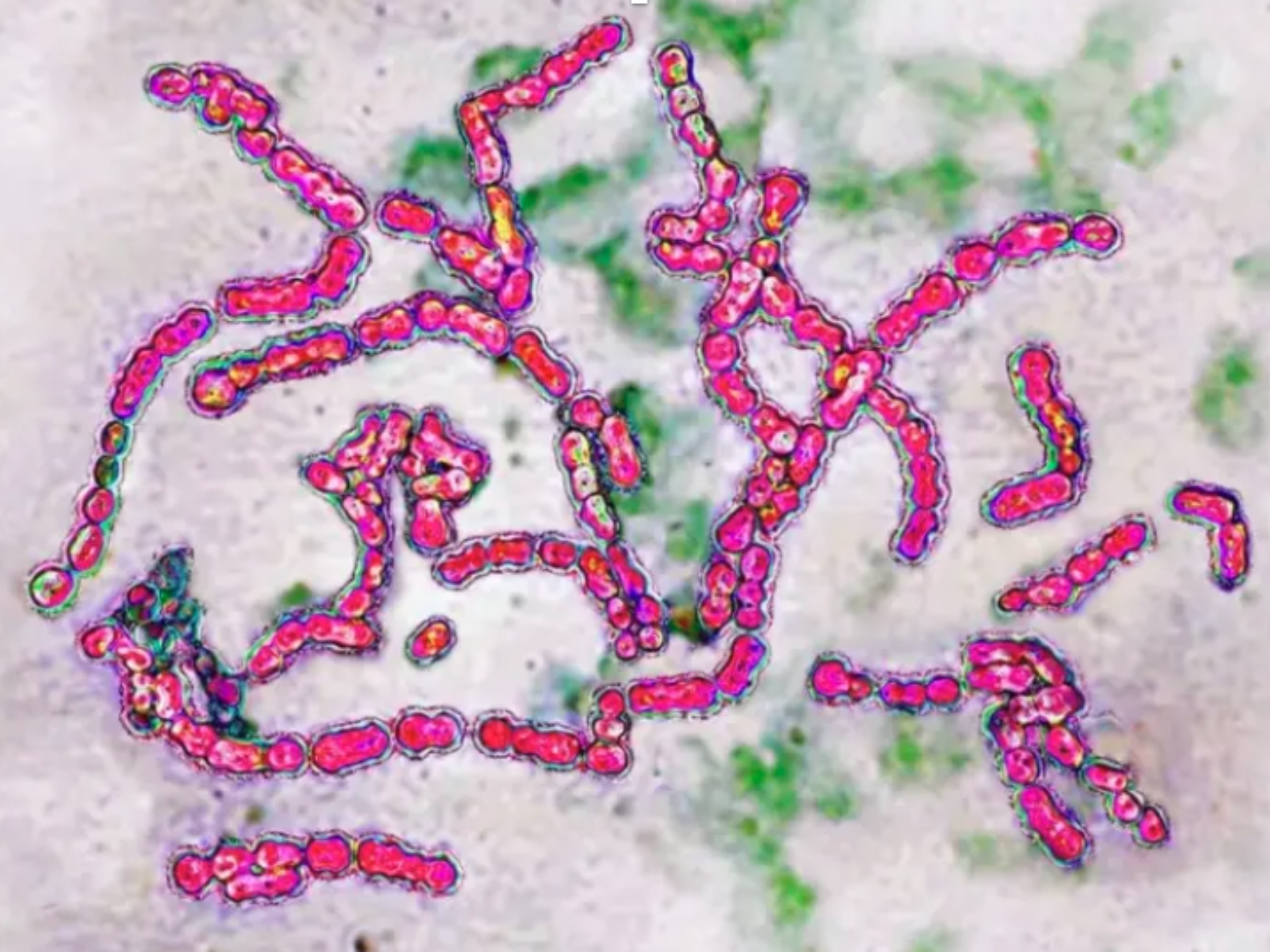 Criança de 6 anos morre por infecção grave causada por bactéria em Curitiba