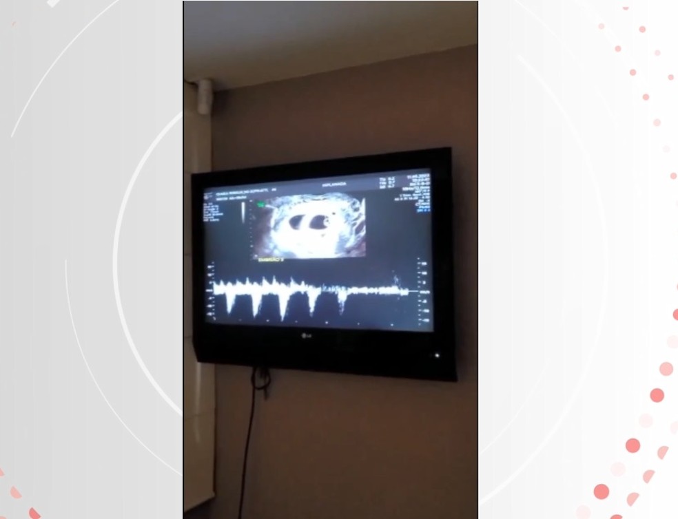 Casal conseguiu ouvir os seis corações dos bebês durante ultrassom — Foto: Reprodução/Redes sociais