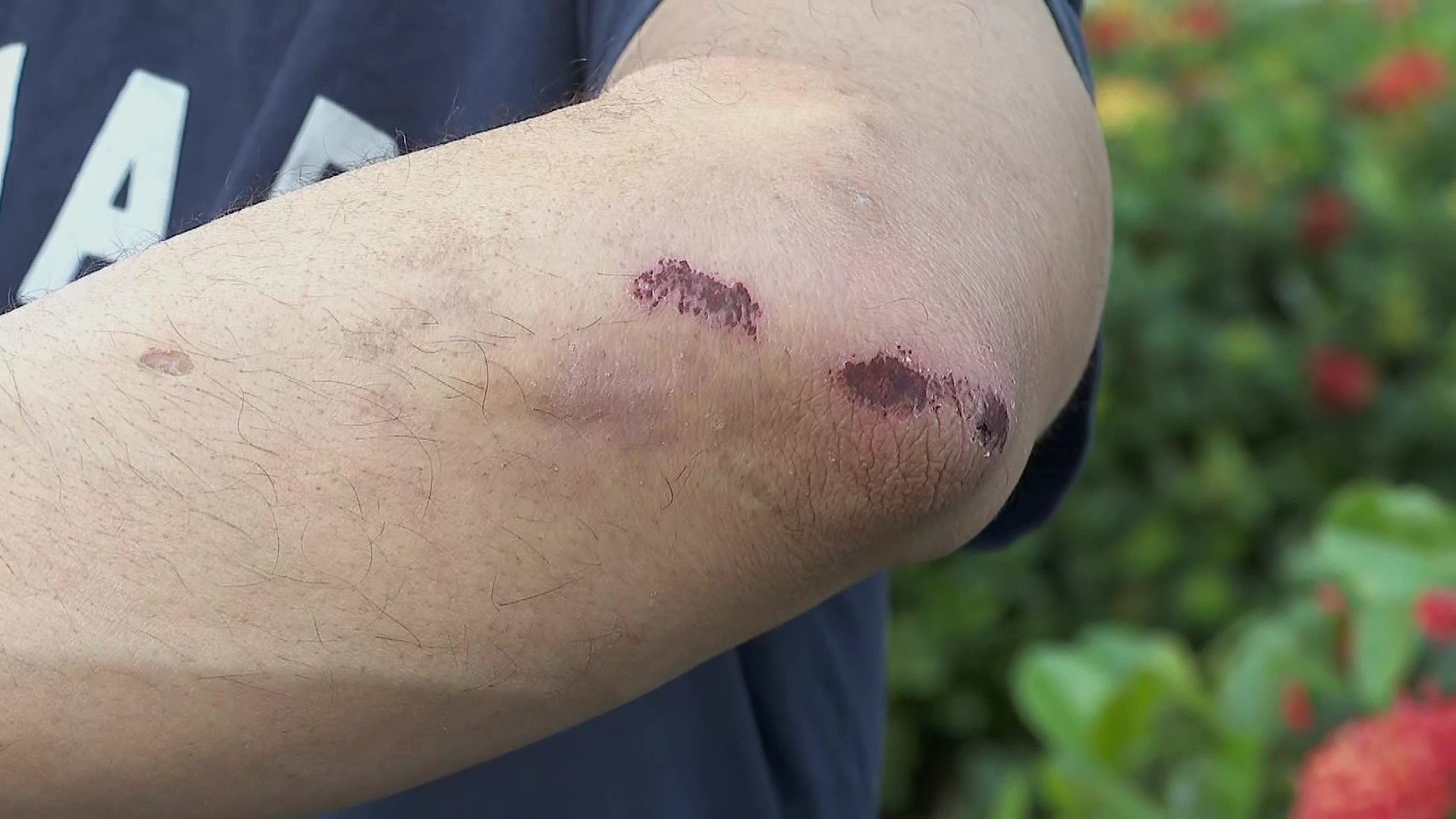 Homem diz ter sido agredido e humilhado por casal em BMW ao ajudar motociclista acidentado