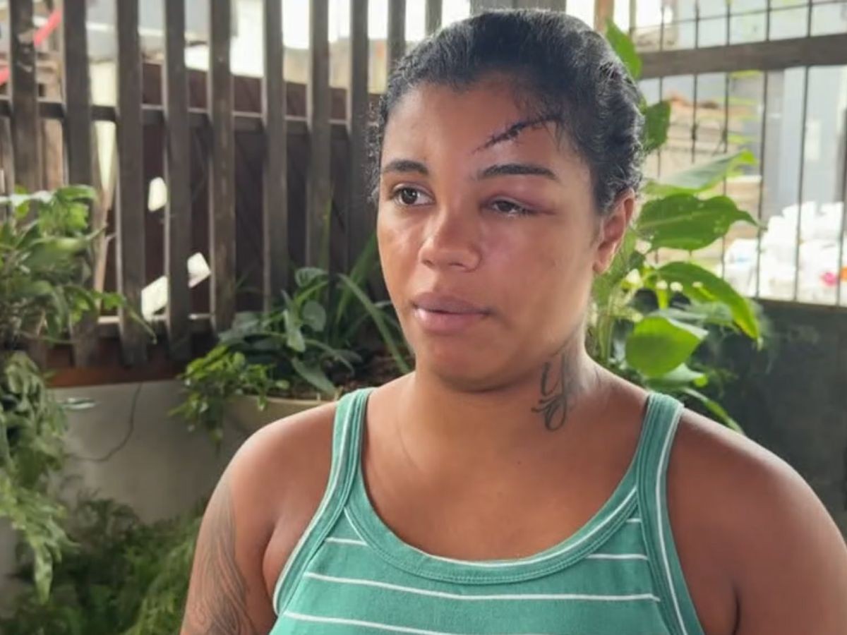'Trauma que vou carregar para sempre', diz jovem que levou paulada na cabeça do ex-marido