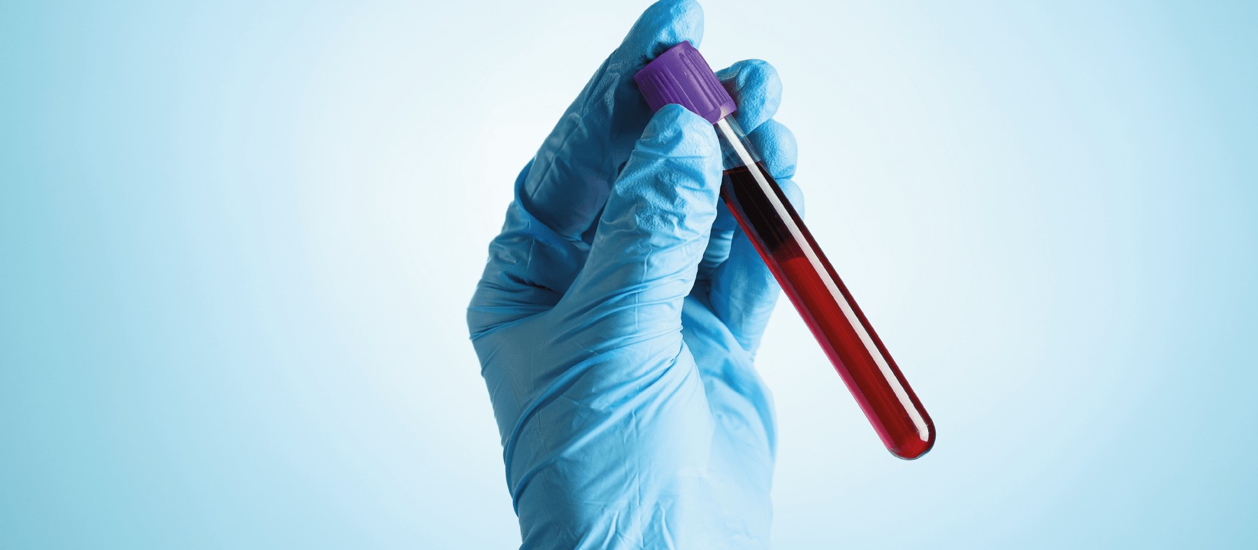 Exame de sangue auxilia na investigação precoce do Alzheimer