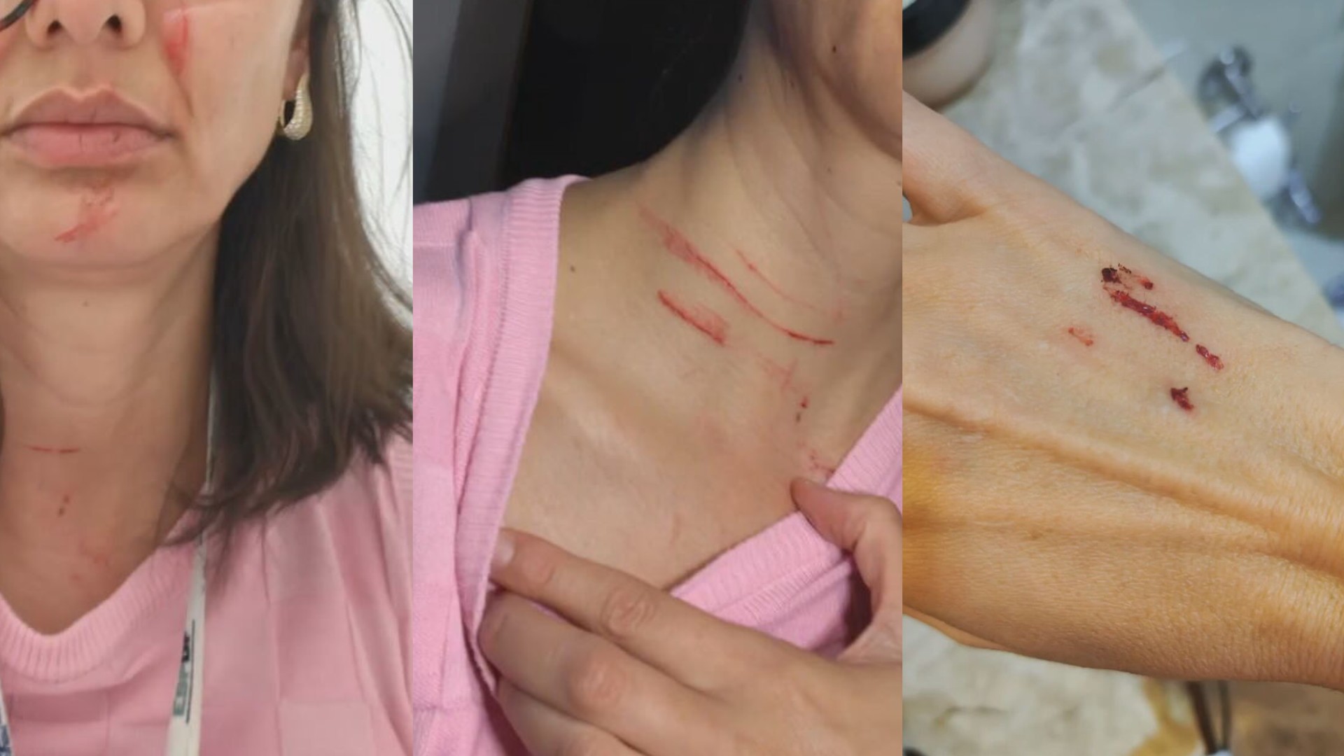 Enfermeira denuncia ter sido agredida em plantão no hospital de Samambaia, no DF 