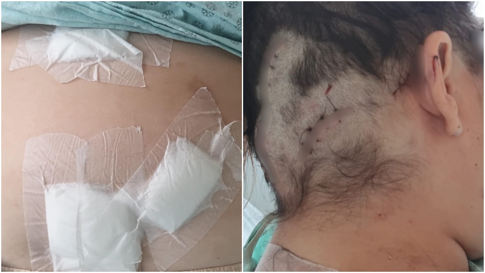 Mulher é mantida em cárcere, torturada e atingida pelo ex com 12 facadas: 'fingi que estava morta'