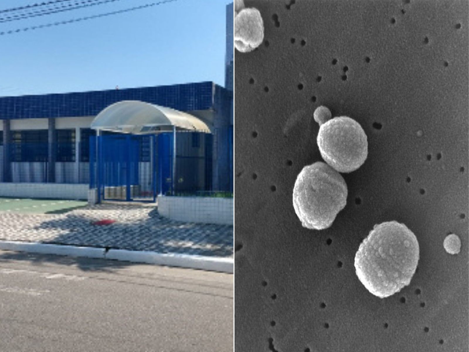 Após morte de menina, segundo caso de meningite bacteriana é confirmado em Praia Grande