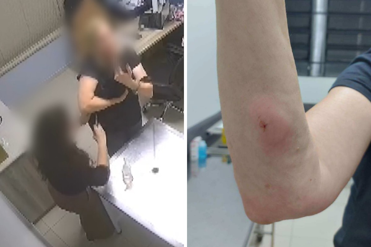 Remédio de cachorra aplicado por engano em tutora era de uso exclusivo a animais; veterinária admitiu erro à polícia