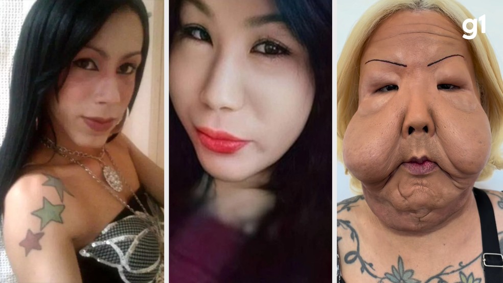 Quem é ’Juju do Pix’, influenciadora do RS que fez cirurgia reparadora | G1