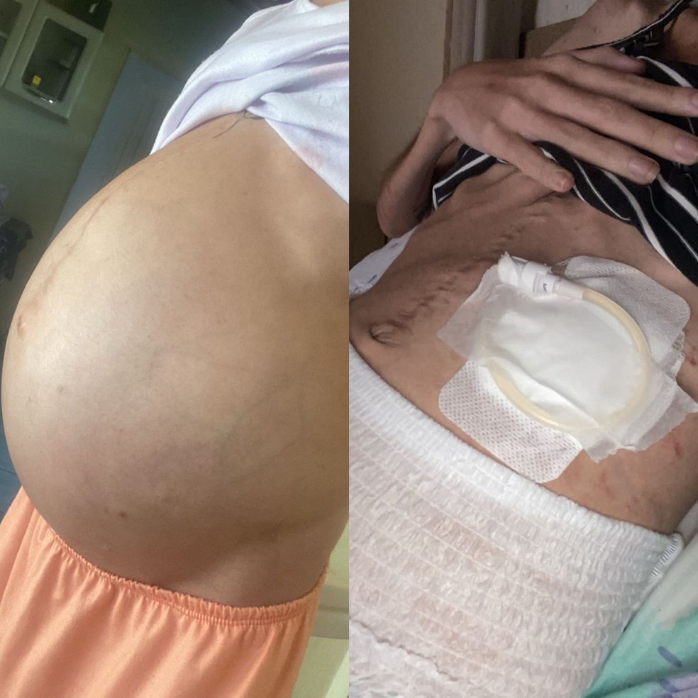 Antes e depois da cirurgia de Linda Ins  Foto: Reproduo