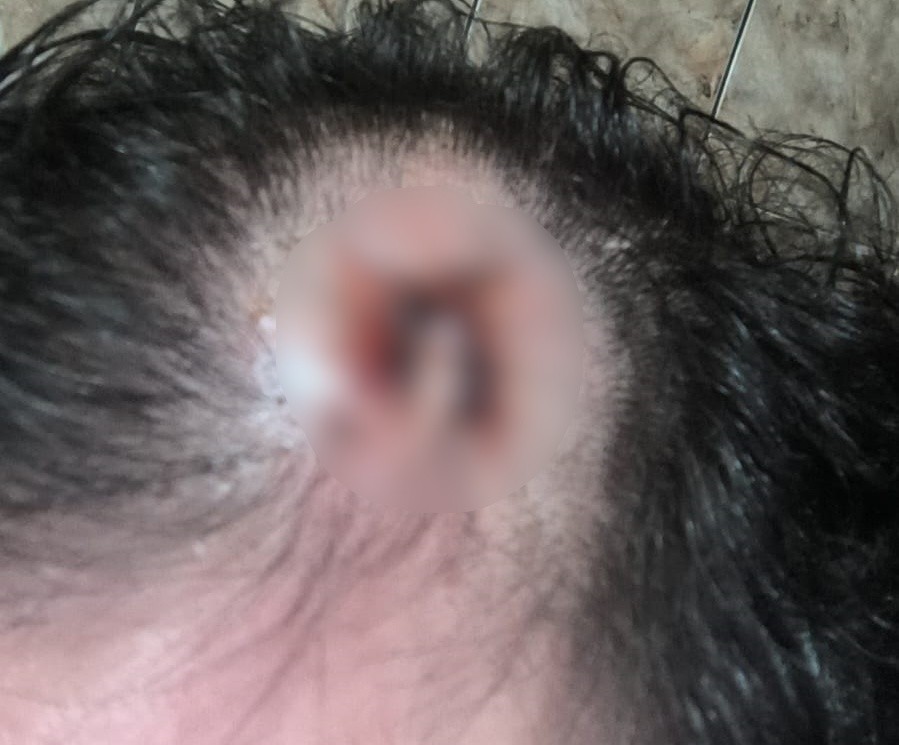 Personal trainer desmaia após ser golpeado na cabeça com peso de academia por aluno no interior de SP