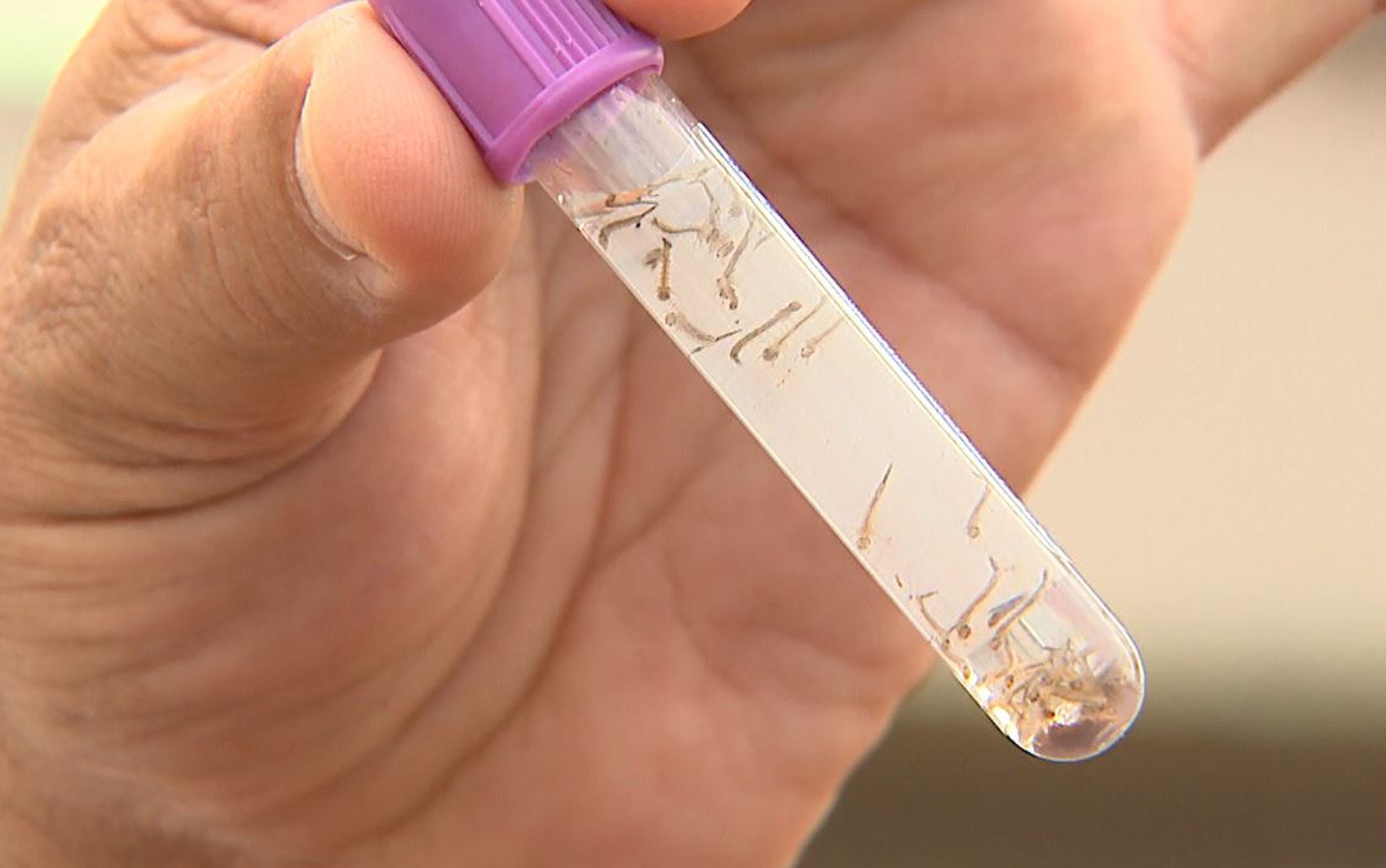 Primeira morte por dengue em 2025 na cidade de SP é de uma criança de 10 a 14 anos