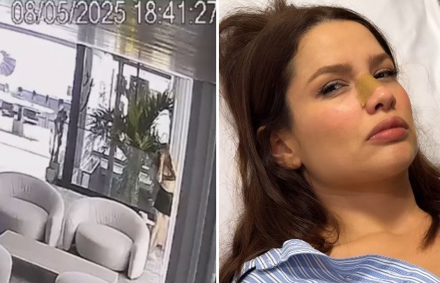 Juliette fratura o nariz em acidente doméstico em casa no Rio
