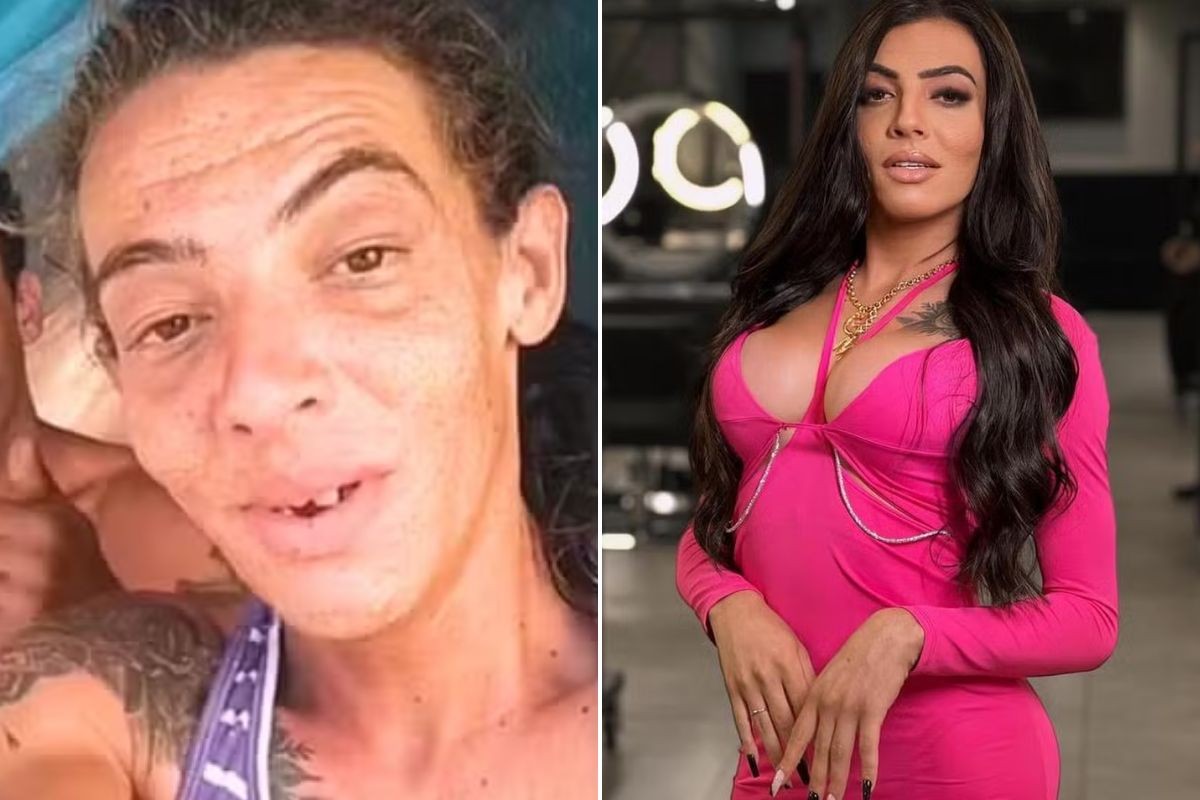 Influenciadora que viveu nas ruas faz 10ª cirurgia e exibe transformação impressionante	