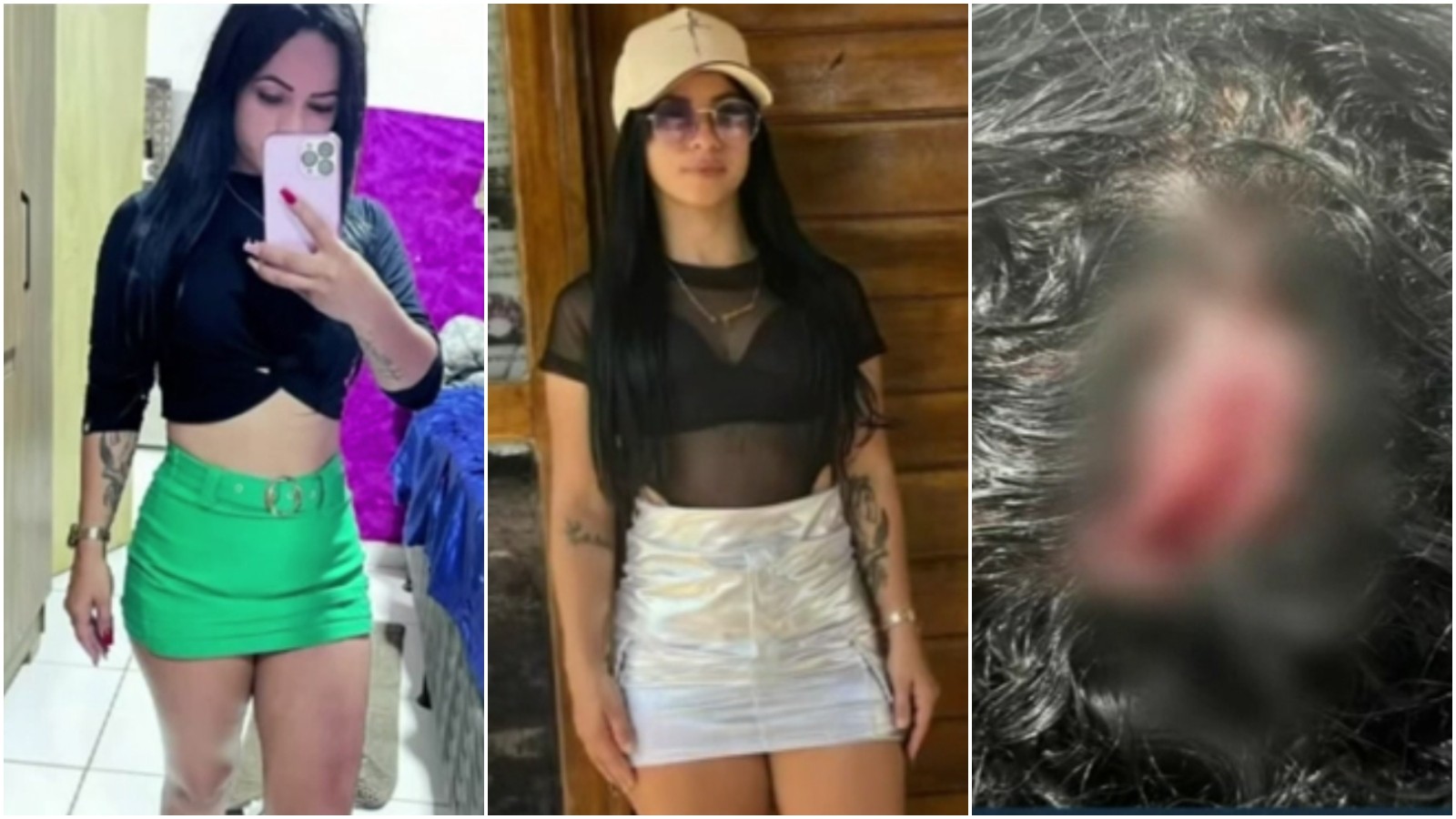 Influenciadora é agredida com taco de sinuca no Ceará; ex-marido é suspeito  do crime | Ceará | G1