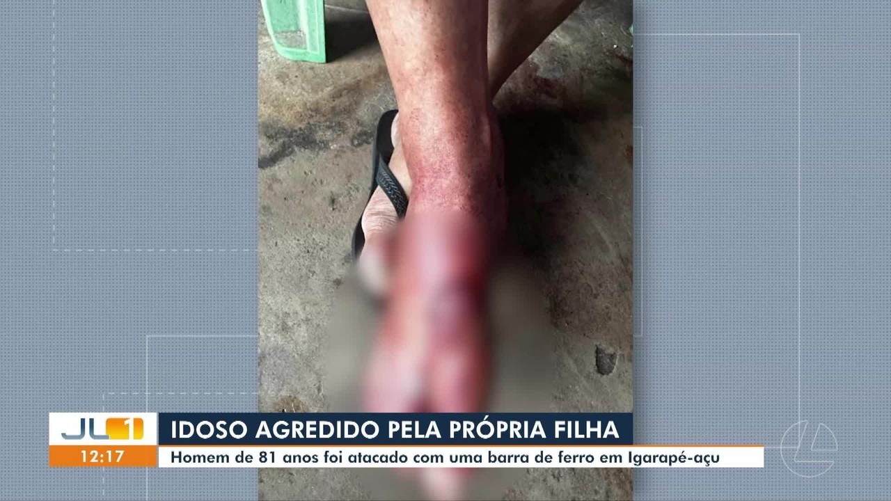 Idoso de 81 anos é agredido com barra de ferro pela própria filha no nordeste do Pará