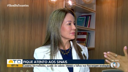 Saiba quais são os principais sinais da alopecia