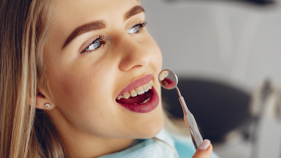 Nova técnica em Tratamento Ortodôntico possibilita Alinhamento dos dentes  mais rápido e com menos consultas