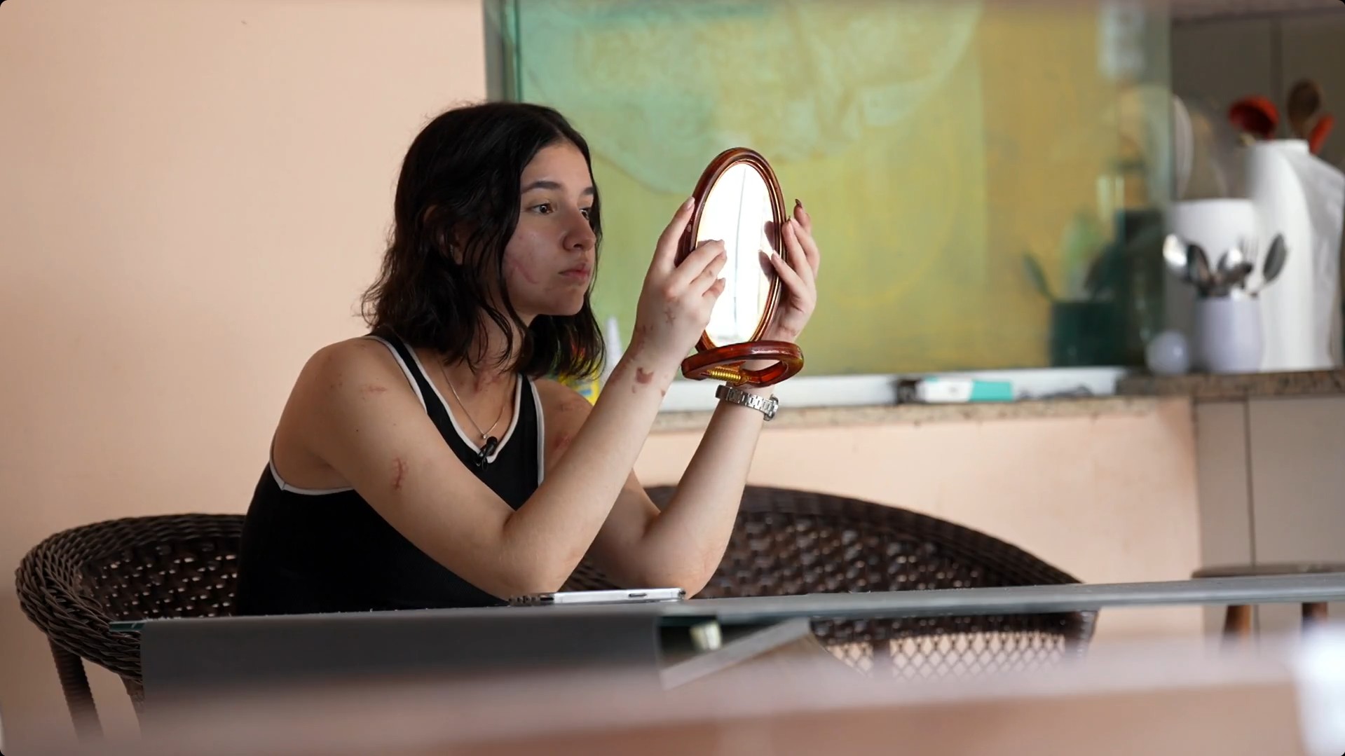 Ataques ao rosto de mulheres revelam intenção de apagar a identidade das vítimas, apontam pesquisadores