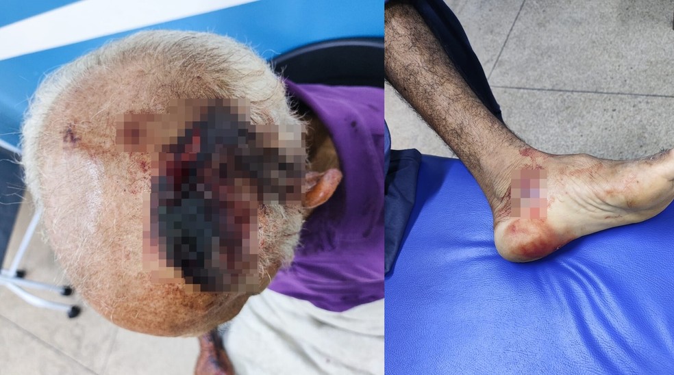 Idoso foi agredido com um fação. — Foto: Policia Militar no Piauí